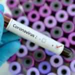 Özel sağlık sigortası poliçeleri corona virüs tedavi giderlerini kapsıyor mu?