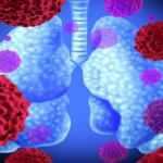 Araştırma sonrası iyileşen koronavirüs hastalarının akciğerlerinde bulundu! 