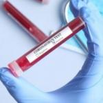 Aytaç Yalman'ın vefatı üzerine gündeme gelmişti: Testte yanlış sonuç çıkar mı?