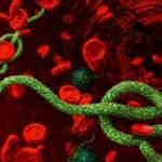 Ebola virüsü nedir? Ebola virüsü nasıl bulaşır? Ebola virüsünün belirtileri nelerdir? 