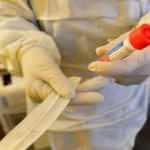 Son dakika: Koronavirüs tedavisinde çığır açan gelişme! 79 yaşındaki hasta bu ilaçla iyileşti