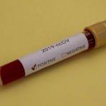 Koronavirüs gıdalardan geçebilir mi?