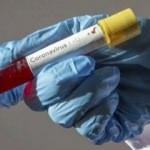 Korkulan oldu! Koronavirüste kritik eşik geçildi