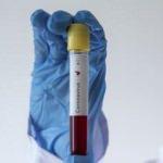 Bakanlık a&ccedil;ıkladı: Vaka ve can kaybı sayısı