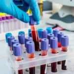 Koronavirüs testlerinde yeni dönem