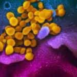 Bir Avrupa &uuml;lkesinde daha can kaybı 10 bini ge&ccedil;ti