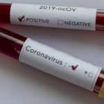 Türkiye'de koronavirüste müthiş gelişme! Birçok hastalığı vardı testleri negatife döndü