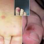 Avrupa'da endişelendiren gelişme: Koronavirüsün yeni belirtileri olabilir