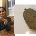Kalp görünümlü patates şaşırttı