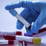 Koronavirüsün seyri bundan sonra nasıl olacak?