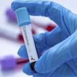 Bir &uuml;lkede koronavir&uuml;s vakası kalmadı, bir &uuml;lke ise &Ccedil;in'i ge&ccedil;ti