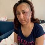Boşanmak isteyen eşine kezzapla saldırdı