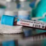 Vali duyurdu: Kentte bugün vaka görülmedi