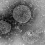 ABD'de koronadan sonra yeni kabus! Hızla yayılıyor: RHDV2