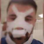 Bayram günü sağlık çalışanını darbeden maganda tutuklandı