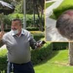 Kurtardığı yavru karganın annesi, kafasını yardı