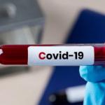 &Ccedil;in koronavir&uuml;s aşısının adını duyurup d&uuml;nyaya resmen duyurdu