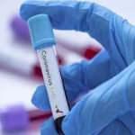 Antikor testi nasıl yaptırılır? Koronavirüse karşı bağışıklık oranınızı gösteren test nasıl ...