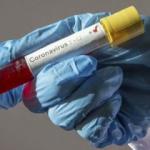 Ateş Kara uyardı! O aylara dikkat