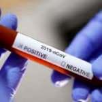 Fabrikada 1029 işçide virüs çıktı