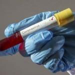 Kız isteme sonrası  5 ev karantinaya alındı!