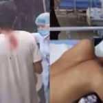 Kafasına bıçak saplanan adamın rahatlığı görenleri şaşkına çevirdi