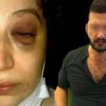 Eski eşi tarafından tehdit ve darp edilen kadın yardım bekliyor
