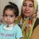 Kelebek hastası Büşra yardım bekliyor