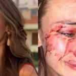 Ukraynalı model dövülmüştü: 6 eğlence mekanı kapatıldı!