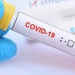 Koronavirüs hükümet düşürdü!