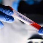 Sivas'ta, iki köy muhtarına koronavirüs soruşturması