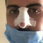 Sosyal mesafe uyarısı yapan hemşirenin burnunu kırdılar