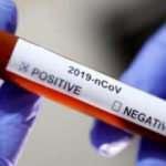 Gaziantep İl Sağlık M&uuml;d&uuml;r&uuml; korona vir&uuml;se yakalandı