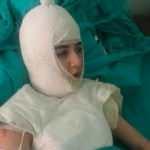 Üvey anne genç kızın başından aşağı kaynar su dökmüştü! Cezaya isyan ettiler