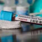 Evine hırsız giren hemşire: Onlar yüzünden koronaya yakalandım