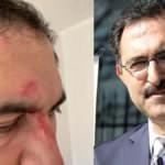 Firari FETÖ'cüyü evire çevire dövdüler