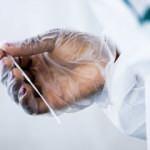 Afrika'da bir günde 5 bin 863 vaka görüldü