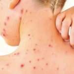 Sağlık Bakanlığı açıkladı: Koronavirüsten daha tehlikeli hastalık patladı