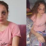 Saçları yolundu gözleri mosmor oldu! Yardım bekliyor