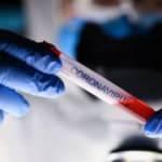 İstanbullulara COVID-19 uyarısı: Bu kış zor geçecek