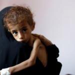 BM: Yemen, kıtlık tehlikesi ile karşı karşıya