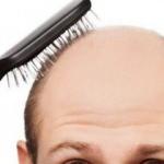 Japon bilim insanları kelliğe çare buldu