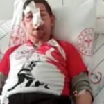 Mazgala takılan bisikletten düştü, burnu kırıldı, kafatası çatladı