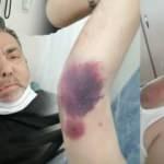 Yüzde 90 engelli vatandaşı darp eden zanlı tutuklandı!