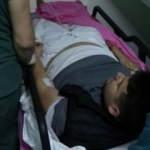 50 lira için hastanelik oldu! Silahla vurdular