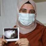 Çocuğunuz olmaz denilen çiftin büyük sevinci