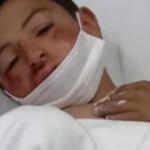 Yola fırlayan &ccedil;ocuk otomobilin altında kalarak yaralandı