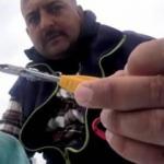 Zehirli balığın anlık teması hastanelik etti