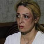 İranlı mimar kadın eşinden &ouml;ld&uuml;resiye dayak yedi