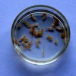 llk kez görülen öldürücü parazit! İsmi 'Adana' oldu